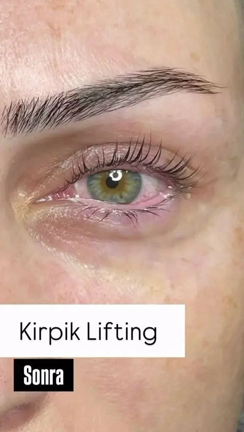 Kaş & kirpik